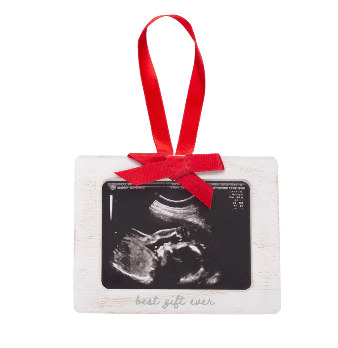 Sonogram Frame Ornament