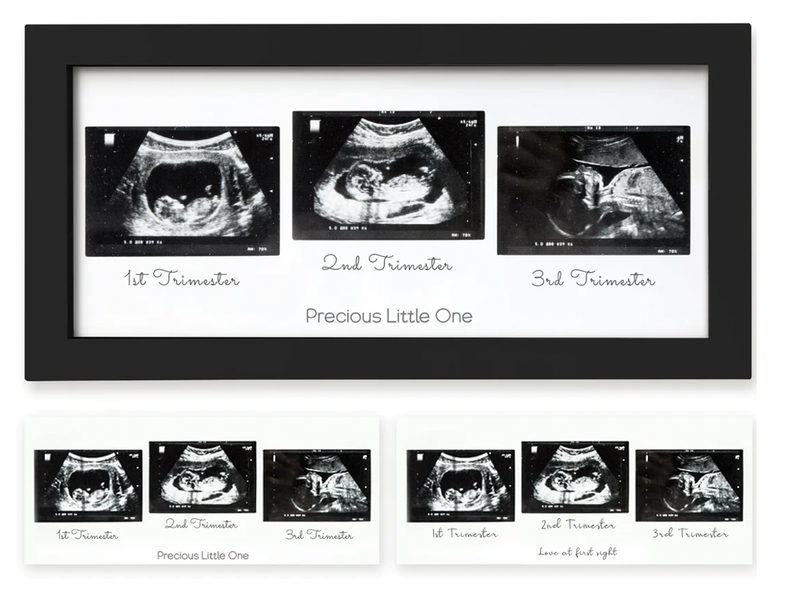 Trio Baby Sonogram Frame